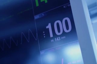 Unikátní operace v Motole. Tříměsíční chlapeček čekal rok na nové srdce - Novinky